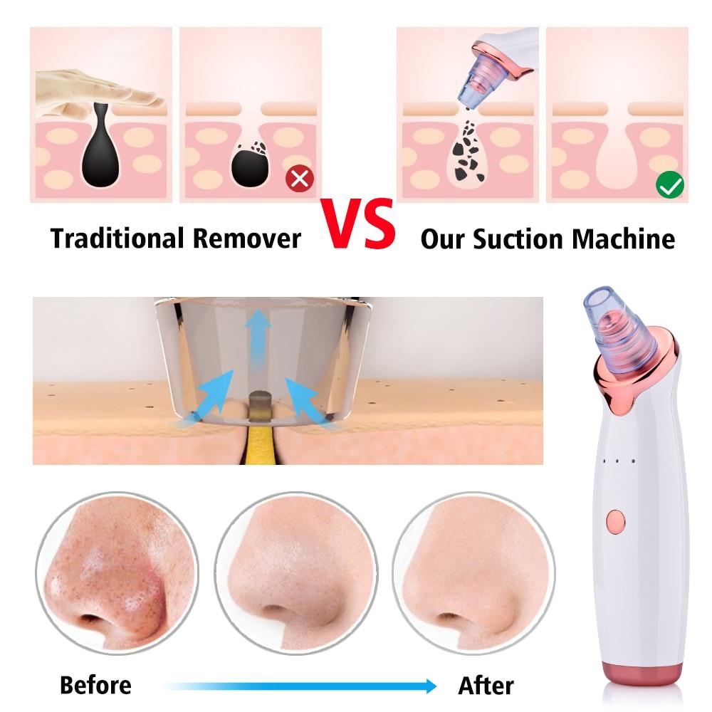 Blackhead Instrument Electric Suction Facial Washing Instrument Beauty Acne Cleaning Blackhead Suction Instrument 9