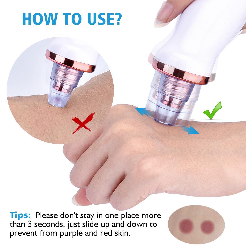 Blackhead Instrument Electric Suction Facial Washing Instrument Beauty Acne Cleaning Blackhead Suction Instrument 10