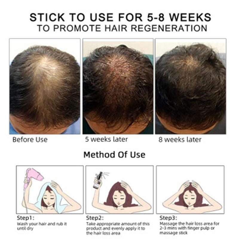Hair Growth Oil Hair Growth Oil Oem Hair Care Essential Oil 3