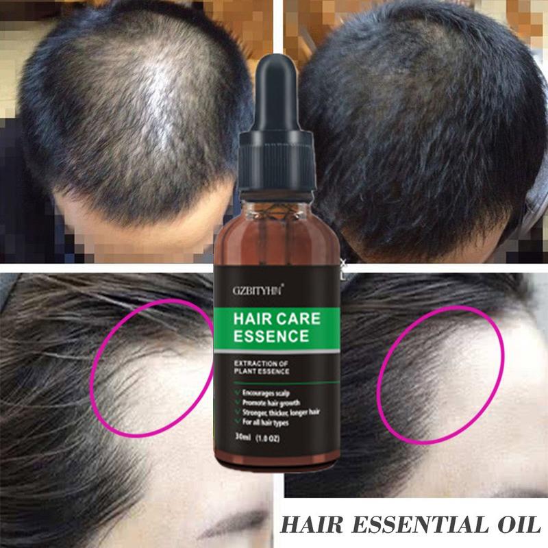 Hair Growth Oil Hair Growth Oil Oem Hair Care Essential Oil 6