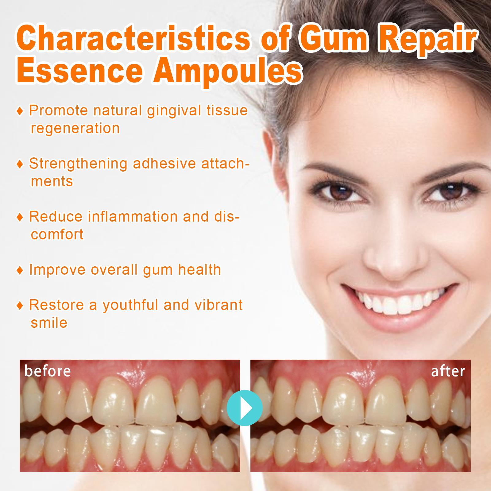 Teeth Repair Deep Cleaning Teeth Yellow Teeth Stain Tartar Care Gum Oral Care 17