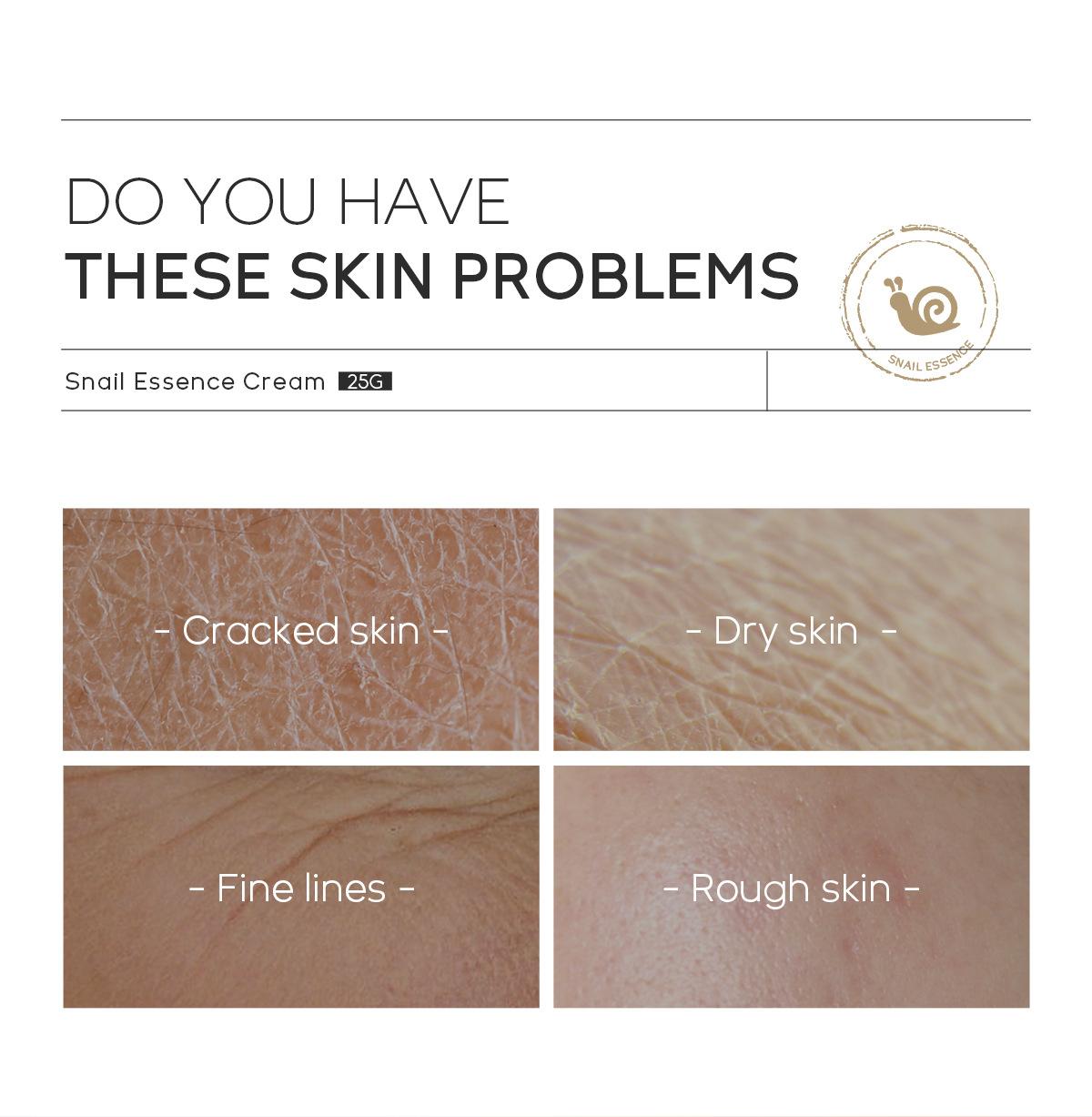 Moisturizing Skin Care Products Laikou Snail Cream 14